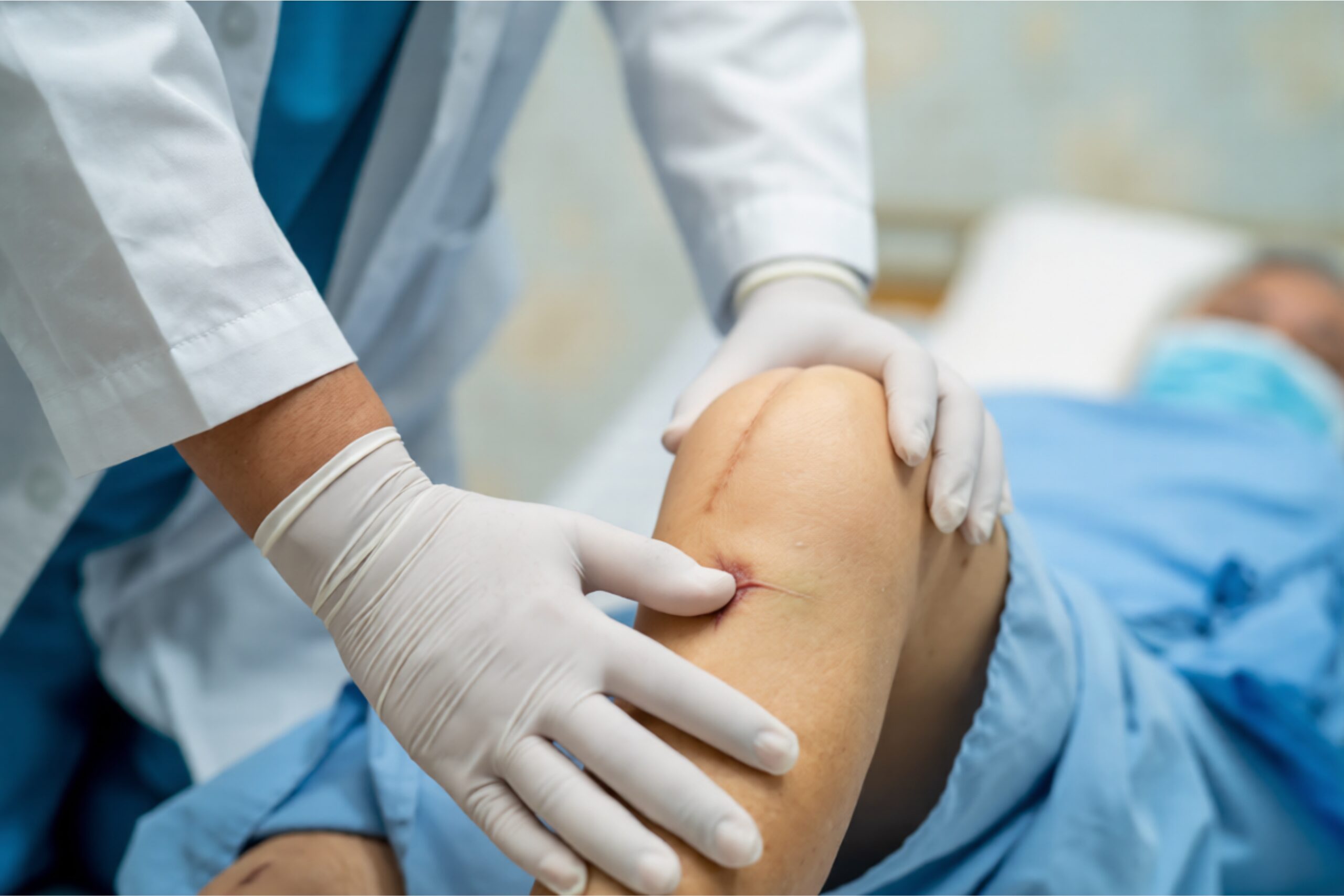 ACL Reconstruction सर्जरी के बाद कितने समय में सामान्य चलना और खेलना संभव है?