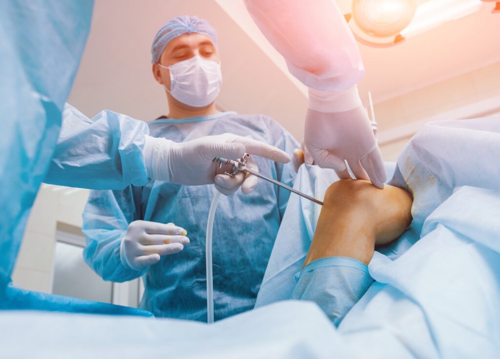 ACL Surgery Cost in India